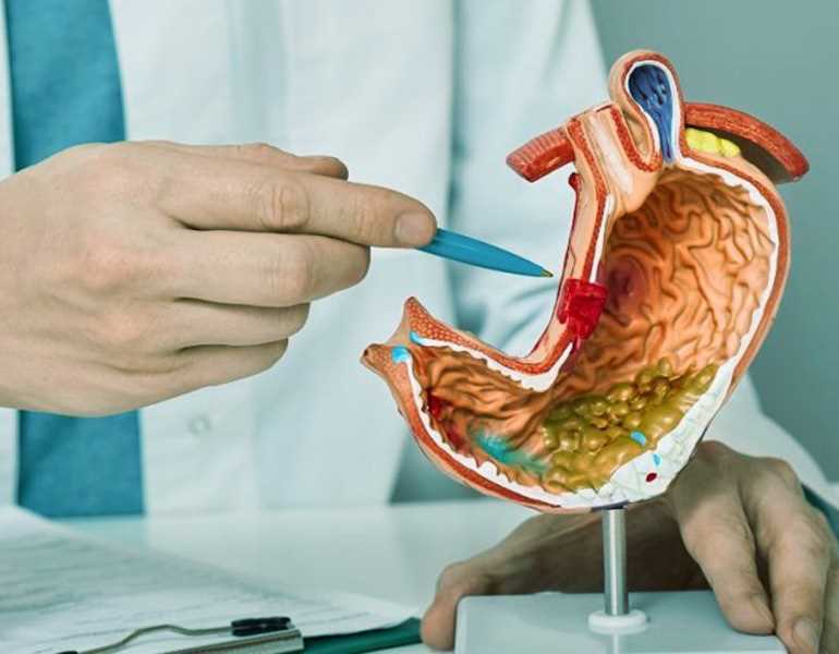 ما هي أعراض سرطان المعدة المبكرة ؟ مؤسسة وارث الدولية لعلاج الاورام